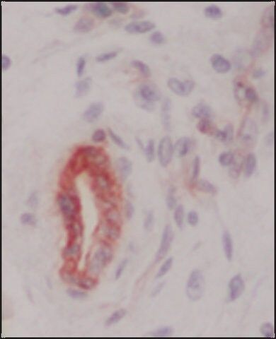 Anti-Collagen Type IV antibody, Mouse monoclonal