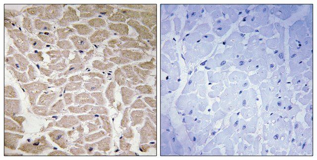 Anti-Collagen XVI 1 antibody produced in rabbit