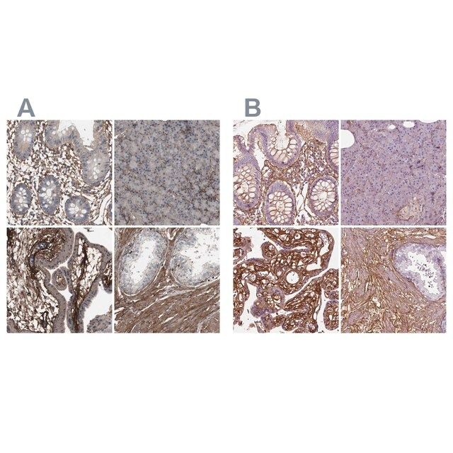 Anti-COL6A2 antibody produced in rabbit