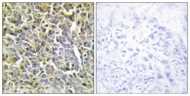 Anti-Collagen VI 2 antibody produced in rabbit