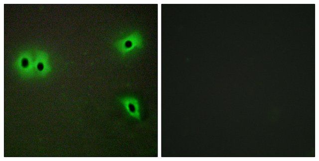 Anti-Collagen XIII 1 antibody produced in rabbit