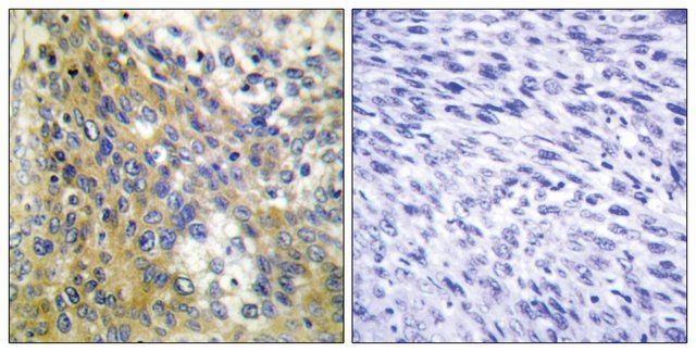 Anti-Collagen IV 6 antibody produced in rabbit