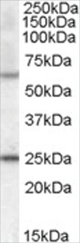 Anti-COL4A3BP (AA 662-672) antibody produced in goat