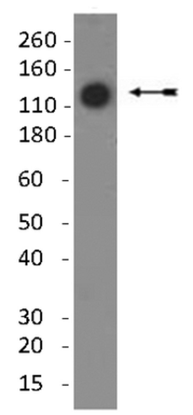 Anti-Collagen Type II Antibody, clone 6B3