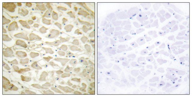 Anti-Collagen XIV 1, N-Terminal antibody produced in rabbit