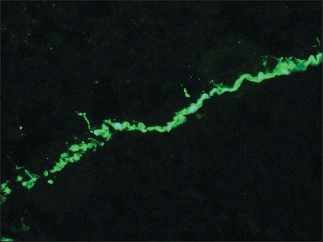 Anti-Collagen, Type VII antibody, Mouse monoclonal