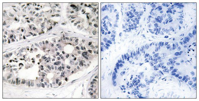 Anti-Collagen VII 1 antibody produced in rabbit