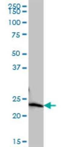 Anti-COMMD10 antibody produced in mouse