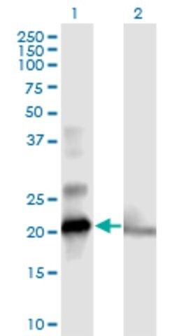 Anti-COMMD1 antibody produced in mouse