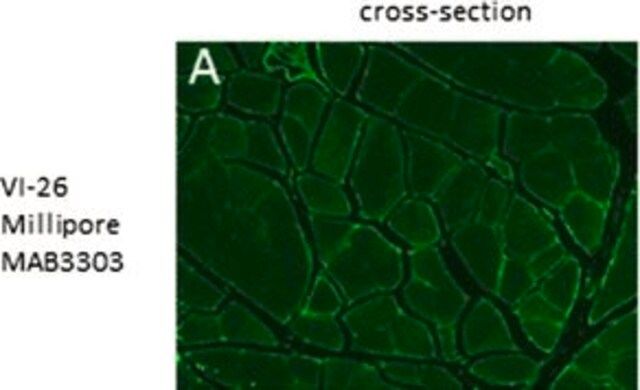 Anti-Collagen Type VI Antibody, clone VI-26