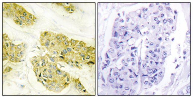 Anti-Collagen V 3 antibody produced in rabbit