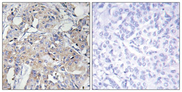 Anti-Collagen VI 3 antibody produced in rabbit