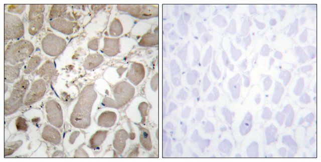 Anti-Collagen V 1 antibody produced in rabbit