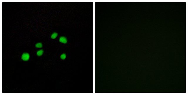 Anti-Collagen XXIII 1 antibody produced in rabbit