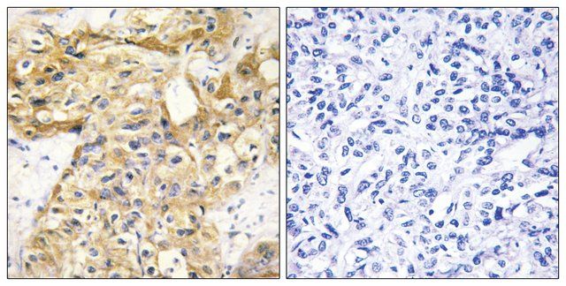 Anti-Collagen XVIII 1 antibody produced in rabbit