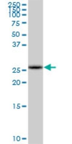 Anti-COMTD1 antibody produced in mouse