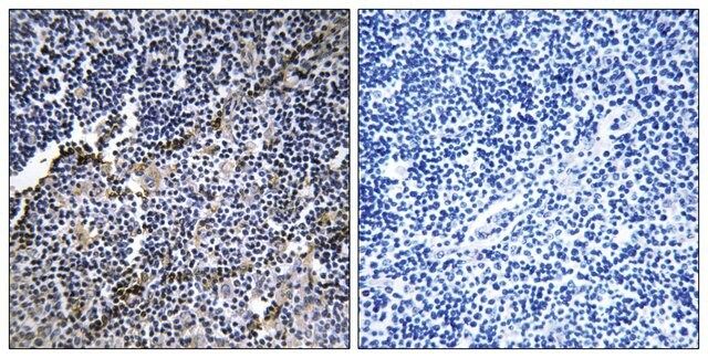 Anti-Collagen XIX 1 antibody produced in rabbit