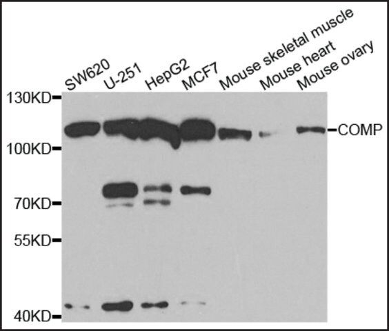 Anti-COMP antibody produced in rabbit