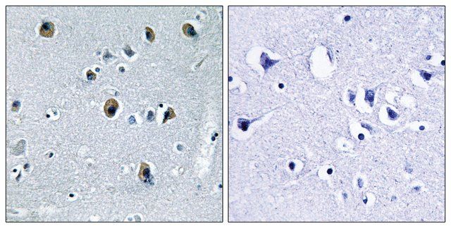 Anti-Collagen XX 1 antibody produced in rabbit