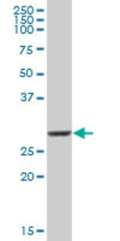 Anti-COMT antibody produced in mouse