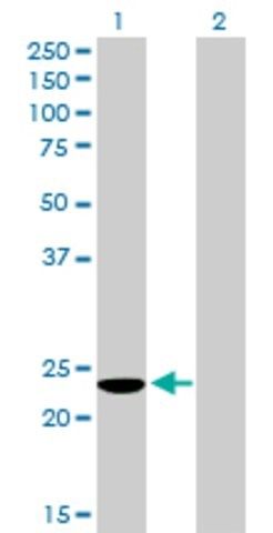 Anti-COMMD3 antibody produced in mouse