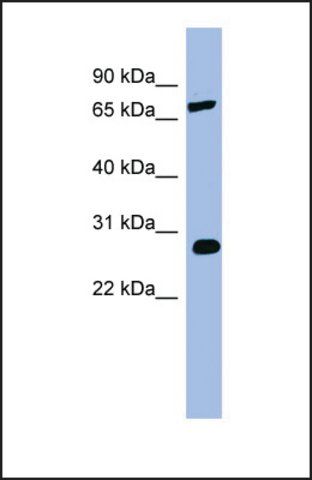 Anti-COMT antibody produced in rabbit