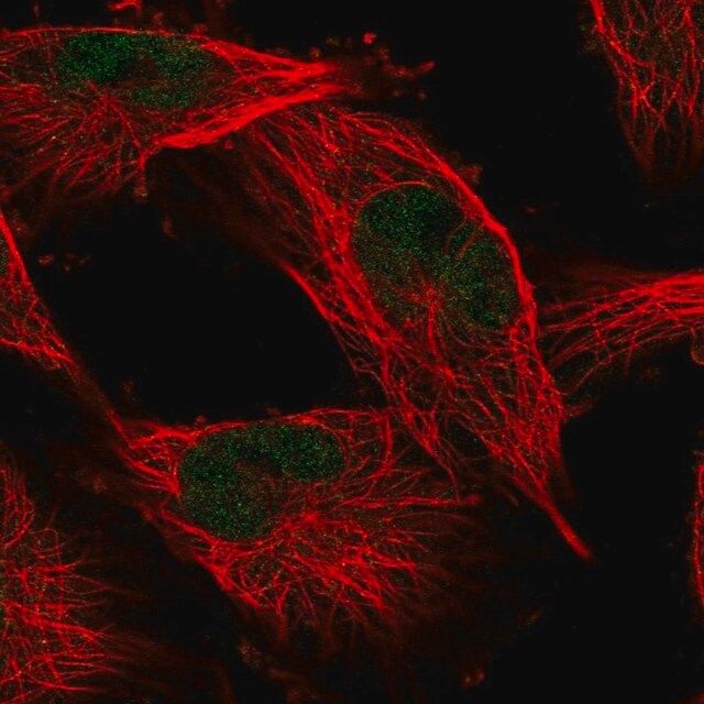 Anti-COMMD1 antibody produced in rabbit