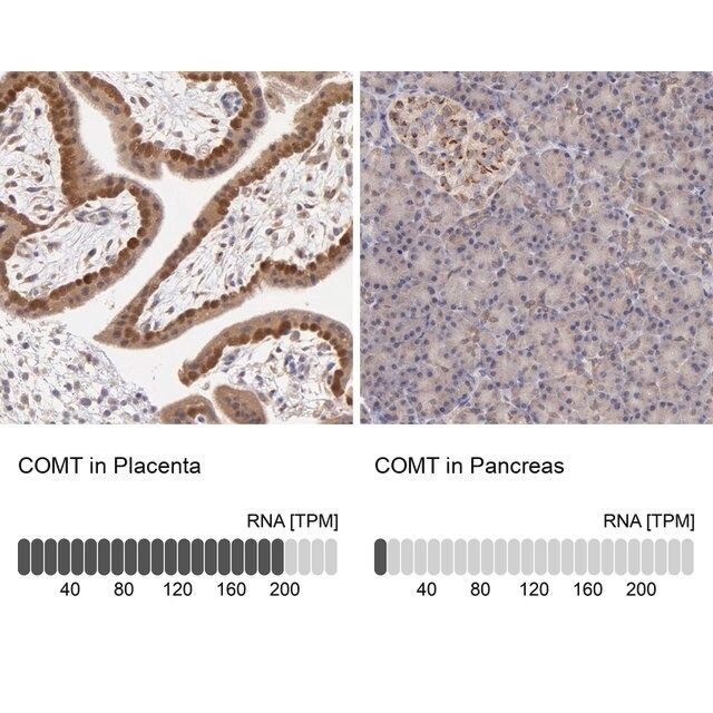 Anti-COMT antibody produced in rabbit