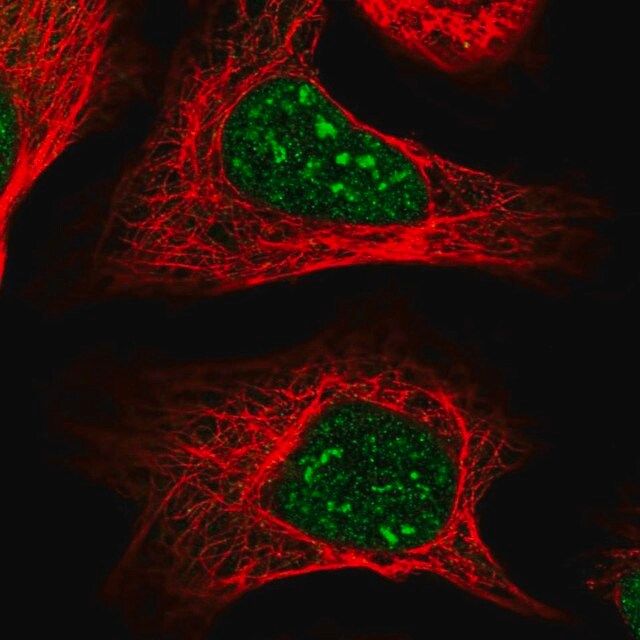 Anti-COPS4 antibody produced in rabbit