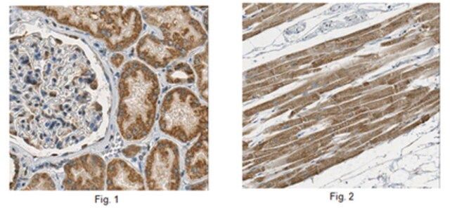 Anti-Complex I-75kD Antibody