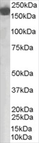 Anti-Complement Factor H antibody produced in goat