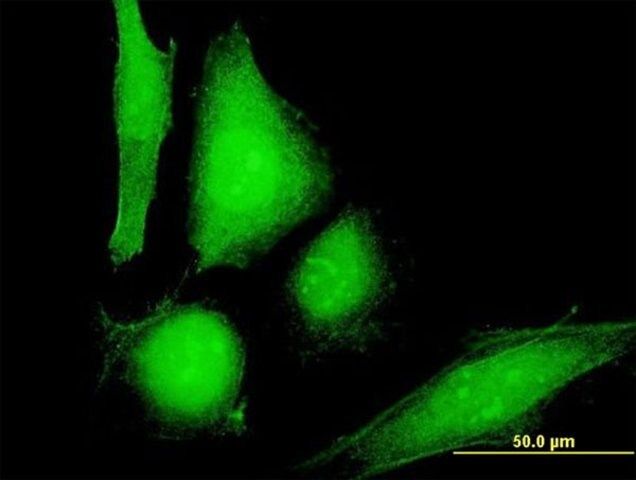 Anti-COP1 antibody produced in mouse