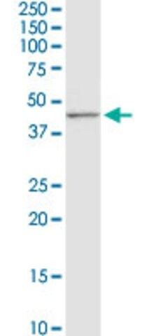 Anti-CD5L antibody produced in rabbit