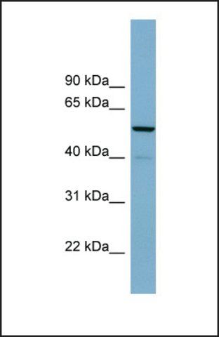 Anti-CDK5RAP1, (N-terminal) antibody produced in rabbit