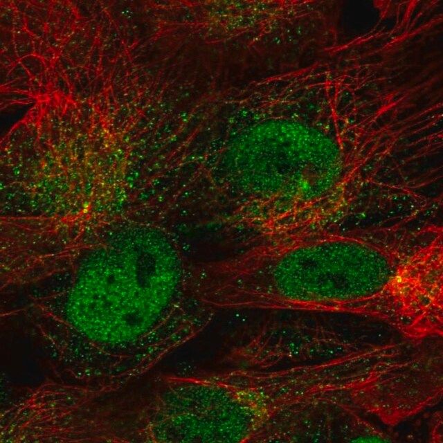 Anti-CDR1 antibody produced in rabbit