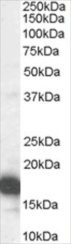 Anti-CDKN2A (Isoform 1)/P16INK4A antibody produced in goat