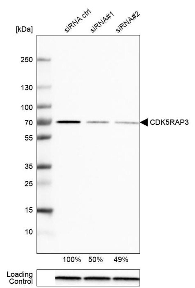 Anti-CDK5RAP3 antibody produced in rabbit