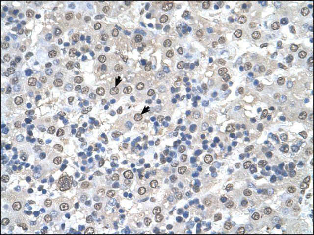 Anti-CDR2 antibody produced in rabbit