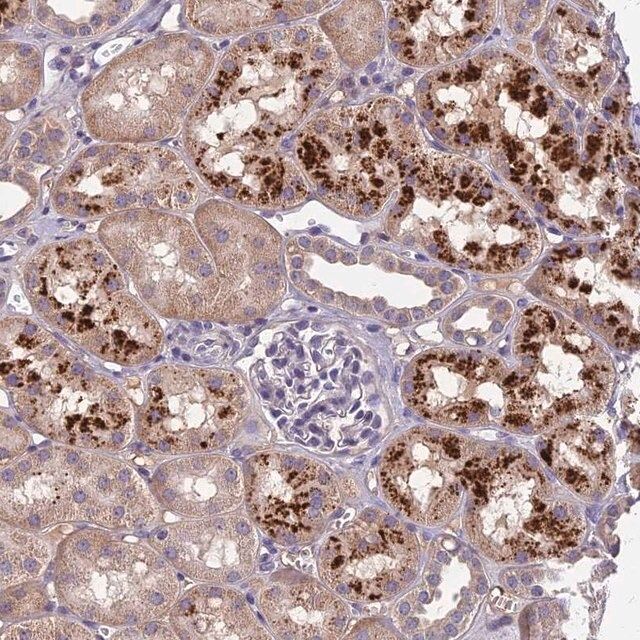 Anti-CEACAM16 antibody produced in rabbit