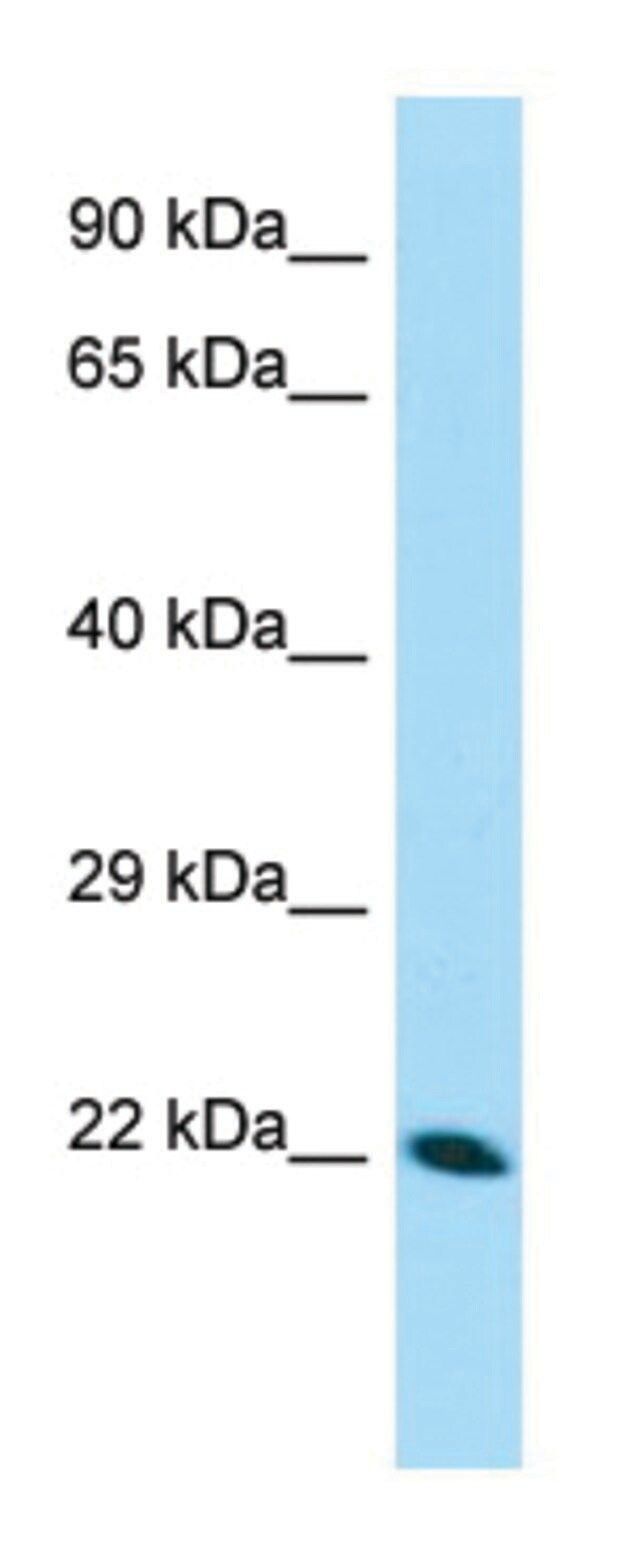 Anti-CDNF (N-terminal) antibody produced in rabbit