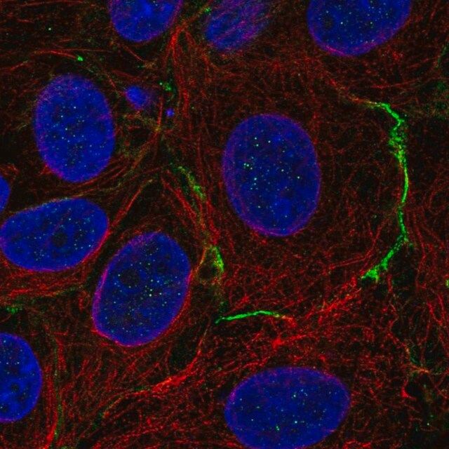 Anti-CELSR1 antibody produced in rabbit