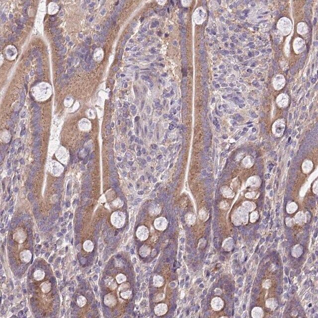 Anti-CEACAM18 antibody produced in rabbit