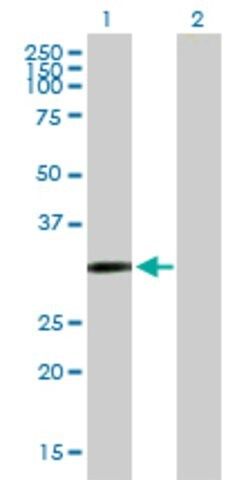 Anti-CDO1 antibody produced in mouse