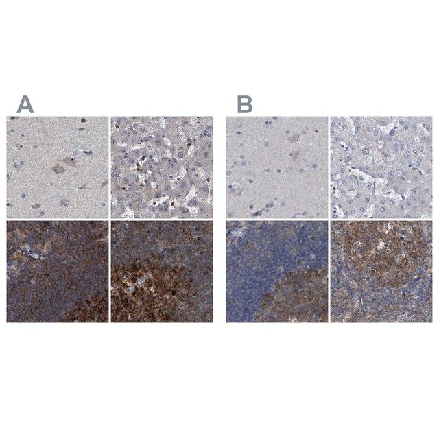 Anti-CDV3 antibody produced in rabbit