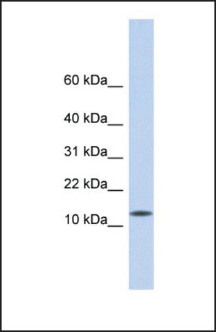 Anti-CDRT4 antibody produced in rabbit