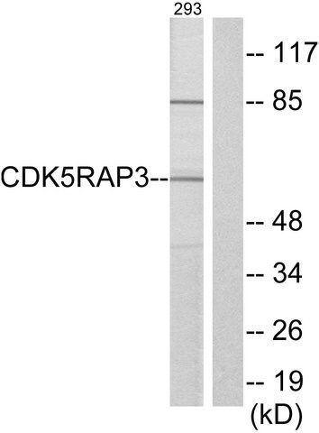 Anti-CDK5RAP3 antibody produced in rabbit