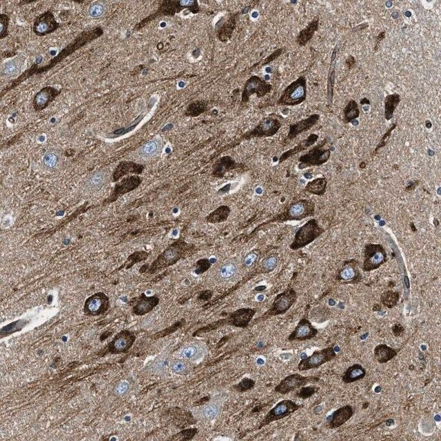 Anti-CDS2 antibody produced in rabbit