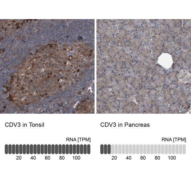 Anti-CDV3 antibody produced in rabbit