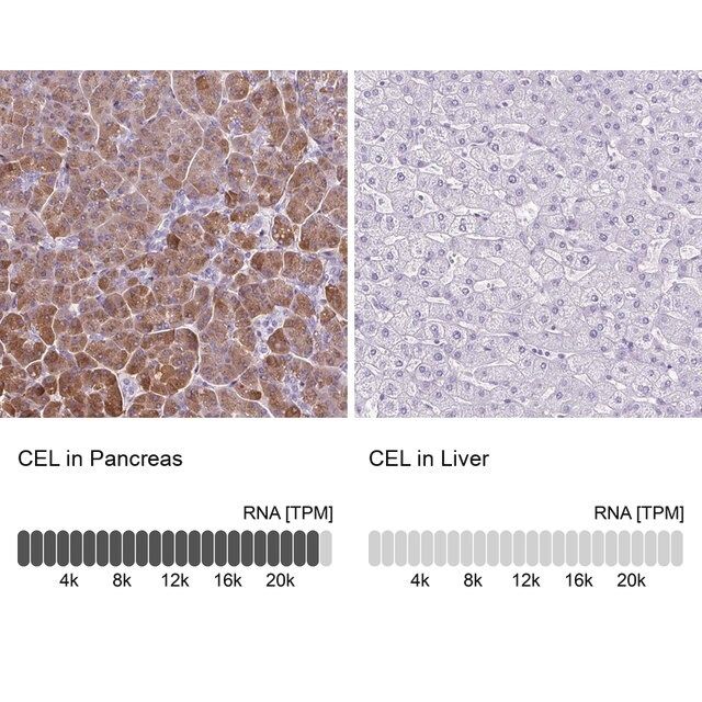 Anti-CEL antibody produced in rabbit