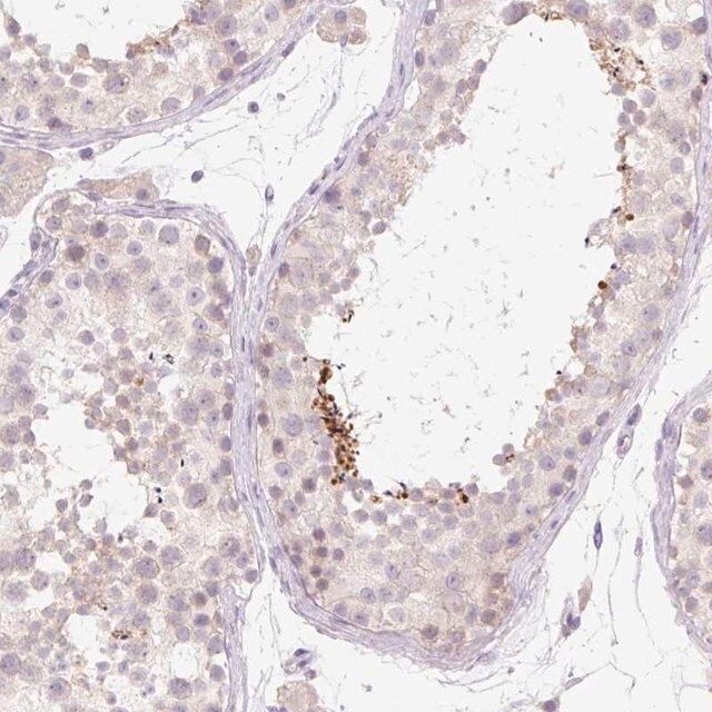 Anti-CELF6 antibody produced in rabbit